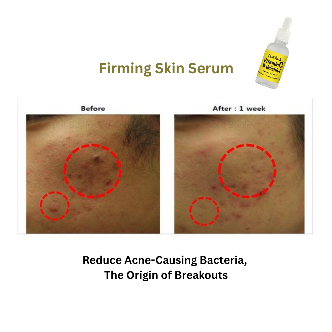 Japan gals - Vitamin C x Bakuchiol (Firming Skin Serum)