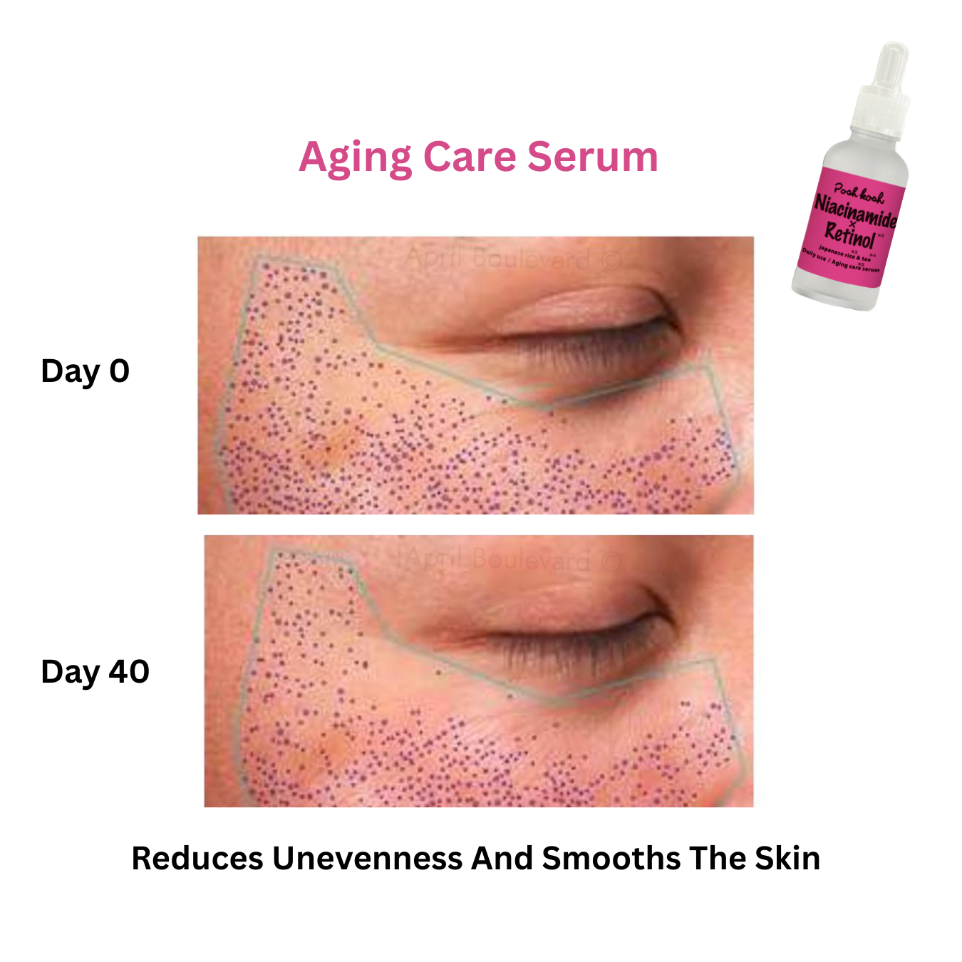Japan Gals -  Niacinamide x Retinol (Aging Care Serum)